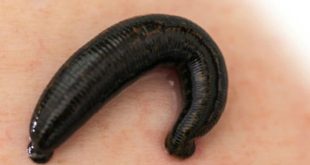 Con đỉa số mấy - Nằm mơ thấy con đỉa đánh con gì